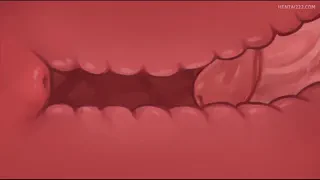 Preview at 00:10