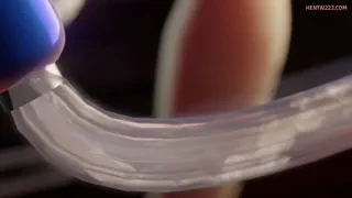 Preview at 00:26