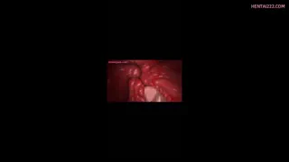 Preview at 00:20