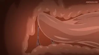 Preview at 00:09